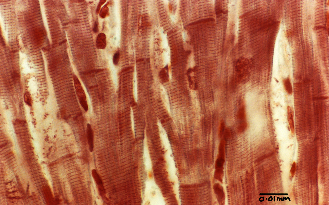 muscle - cardiac